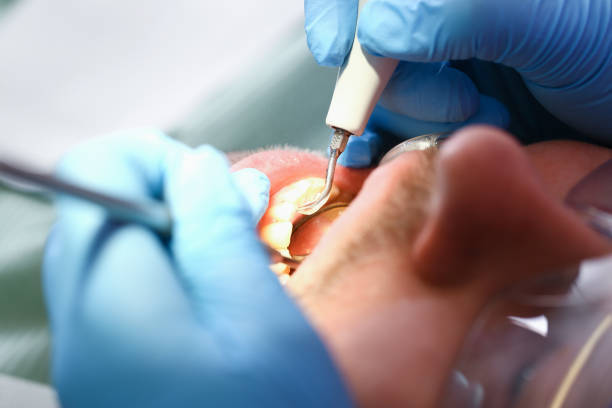 Best Chipped Tooth Repair Near Me  in Leon Valley, TX
